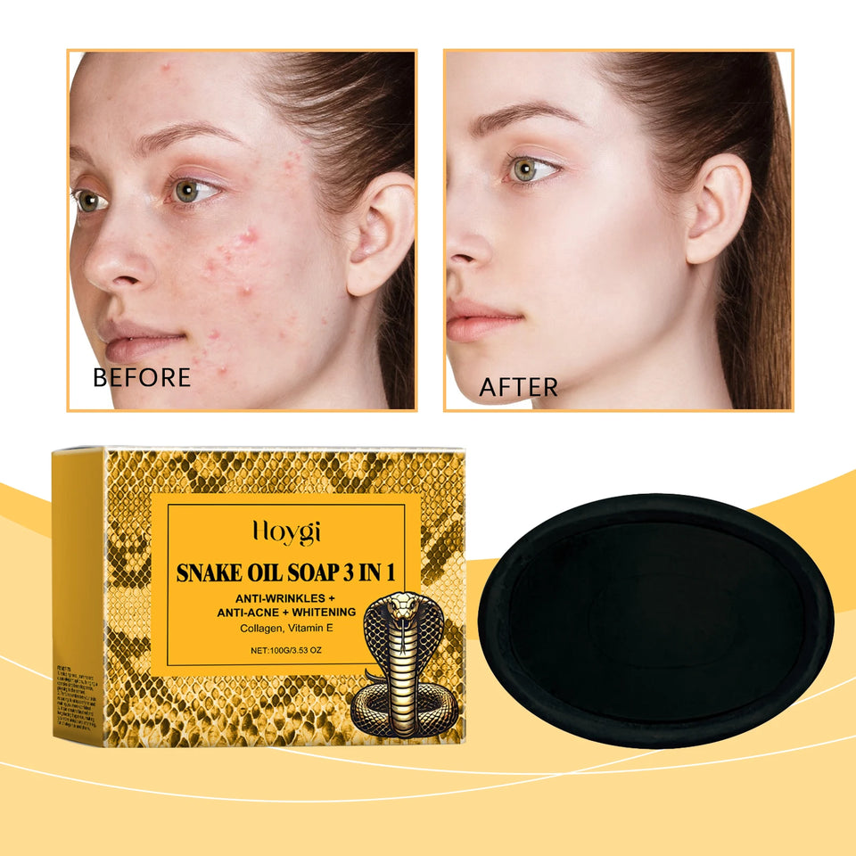 Hoygi Snake Oil Cleansing Soap Gently Cleanses Facial Skin, Leaving it Soft, Smooth, Refreshing, and Oil Controlling 100g
