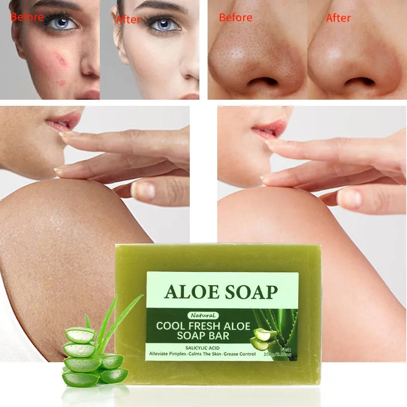 1/2/4/6Pcs Aloe Vera Whitening Soap, Remove Acne, Pimples, Skin Radiant, Improve Skin Luster, Vegan Bath Wash for All Skin Types
