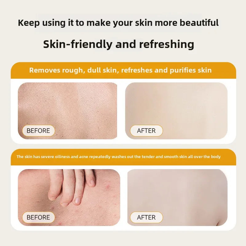 300ml Japanese Sulfur Liquid Soap Removing Mites Bath Gel Deep Cleaning Mites Removal Shower Gel Body Cleaning Health Care