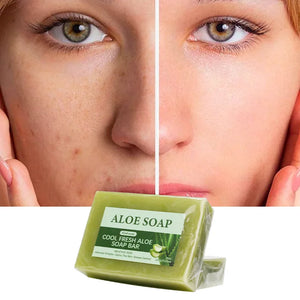 1/2/4/6Pcs Aloe Vera Whitening Soap, Remove Acne, Pimples, Skin Radiant, Improve Skin Luster, Vegan Bath Wash for All Skin Types