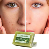 1/2/4/6Pcs Aloe Vera Whitening Soap, Remove Acne, Pimples, Skin Radiant, Improve Skin Luster, Vegan Bath Wash for All Skin Types